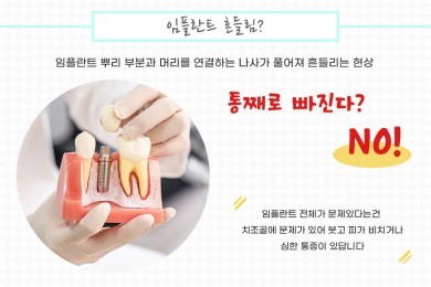 서울탑치과병원, 임플란트 나사가 풀리지 않으려면? 대표 이미지