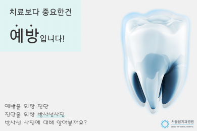 치과를 처음 방문하면 꼭 찍게되는 방사선사진, 찝찝하셨나요? 대표 이미지