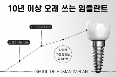 서울탑이 알려주는 임플란트가 만들어지는 과정 대표 이미지